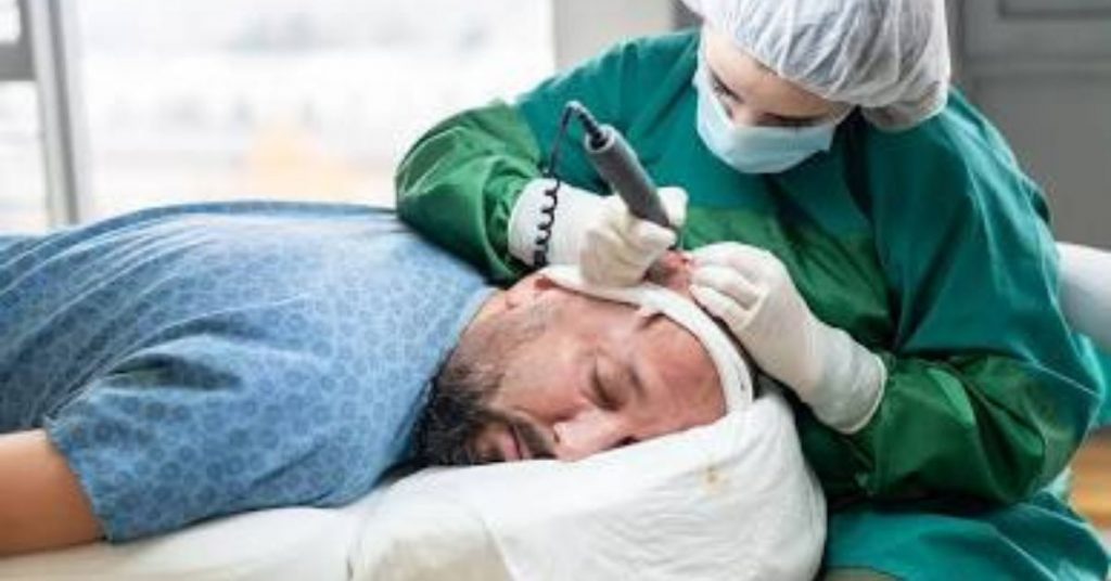 Men’s Hair Restoration Guide